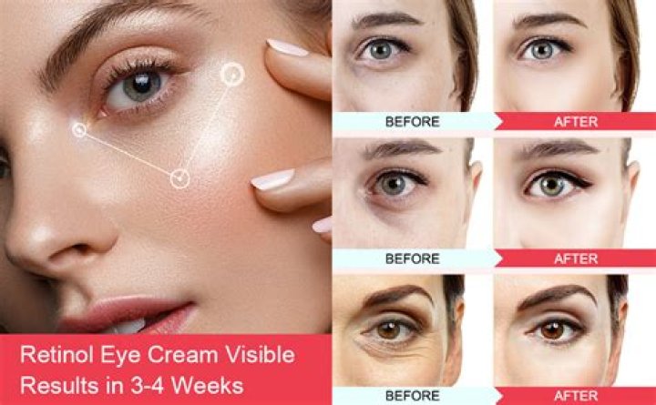 Best retinol cream - How To Discuss