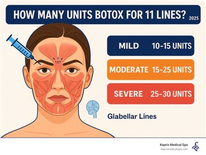 Botox 11 lines - How To Discuss