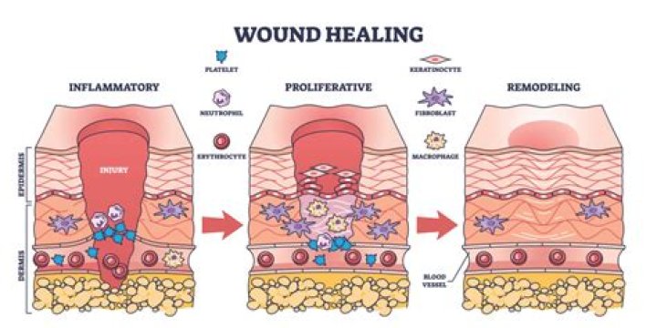 Can chronic wounds heal