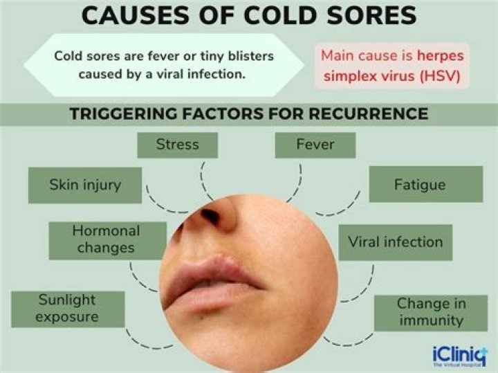 Can Dog Saliva Cause Cold Sores