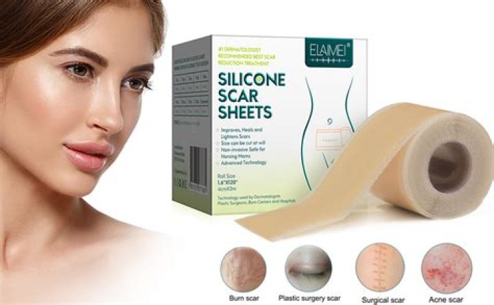 Can you use silicone on a roof