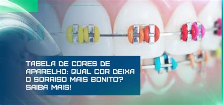 Cores Aparelho Mais Bonitas - How To Discuss