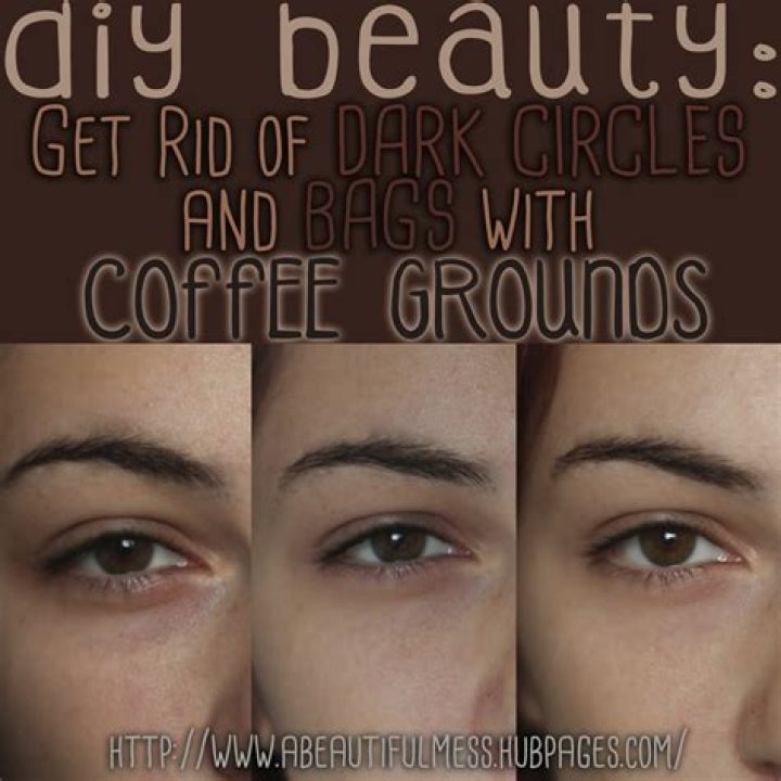 Does coffee grounds reduce dark circles