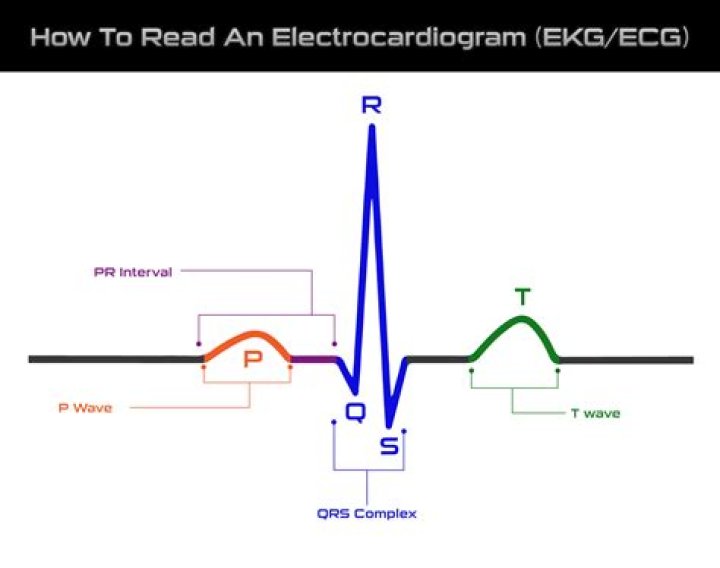 How are ECG signals acquired by sensing electrodes?