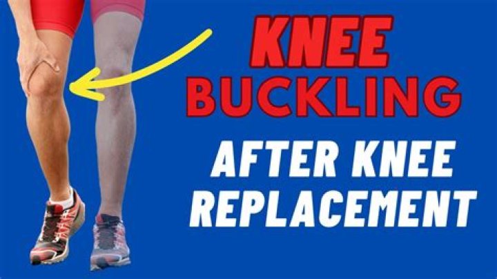 How bad is buckling your knee?