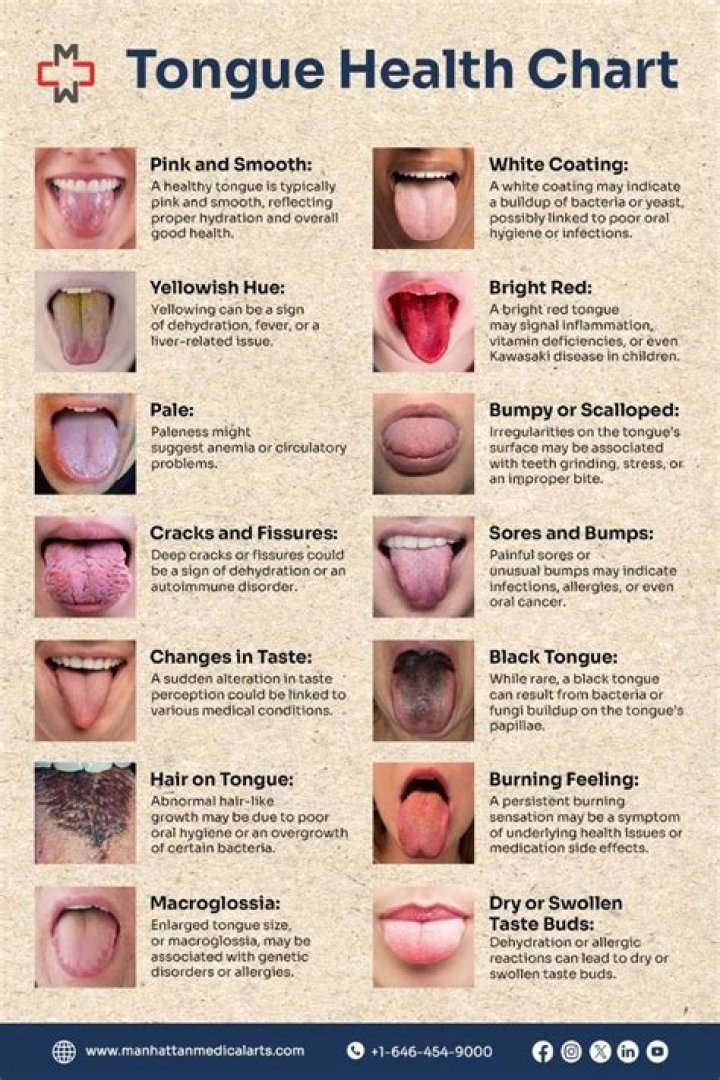 How can I make my tongue healthy