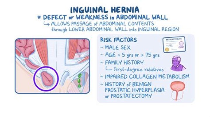 How common is inguinal hernia in infants