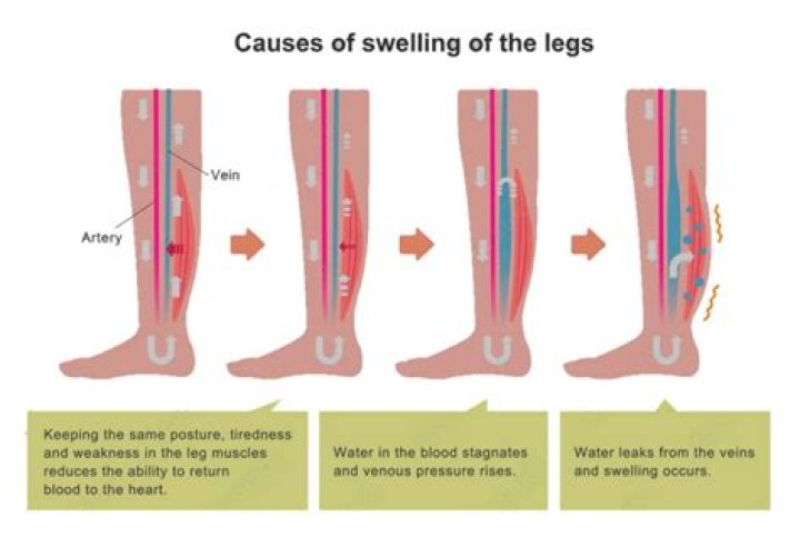 How do I retention my RV awning?