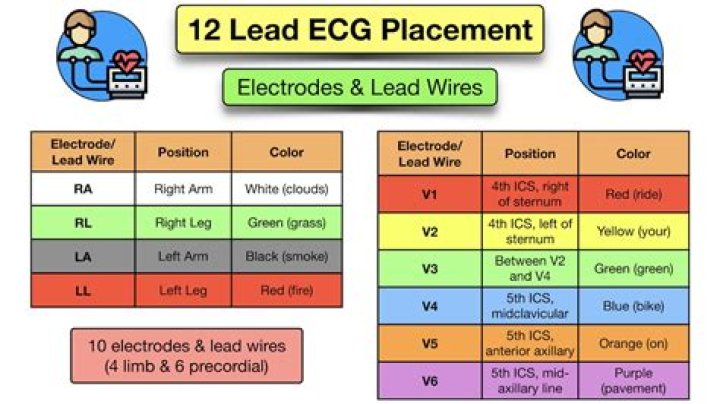How do you place a 3 lead ECG electrode