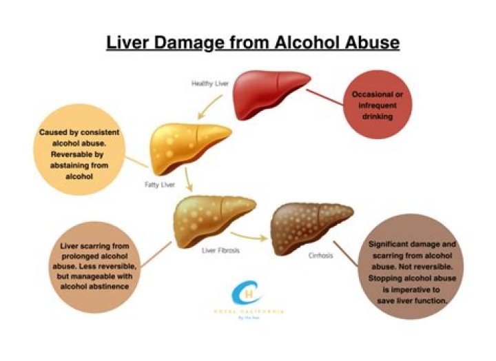 How does liver disease affect drug elimination