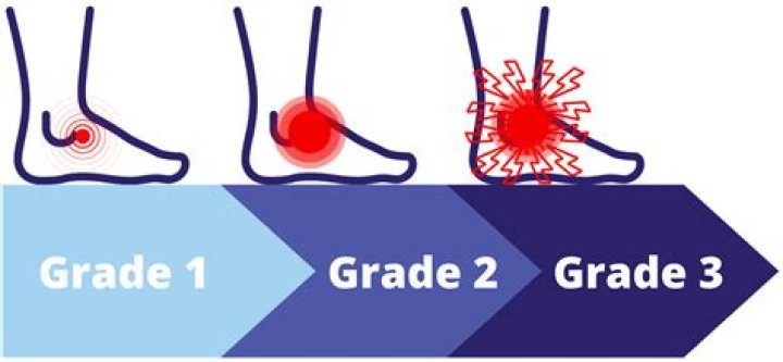 How long does a Grade 3 high ankle sprain take to heal
