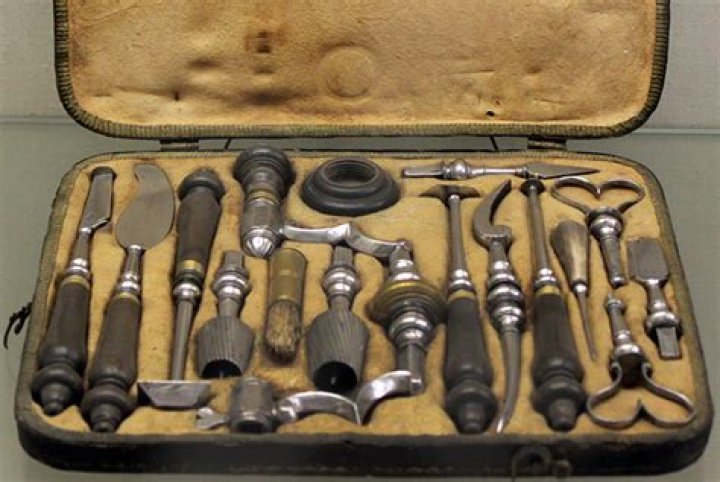 How was trepanation performed