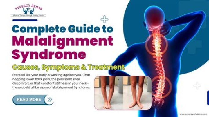 Is miserable malalignment syndrome rare