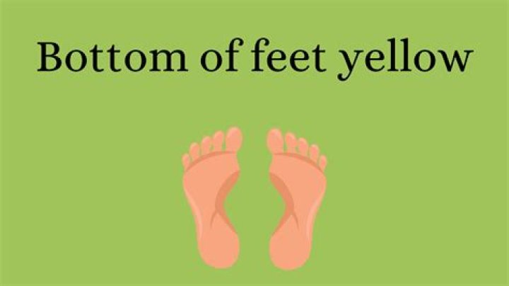 Question: Why Is The Bottom Of My Feet Orange
