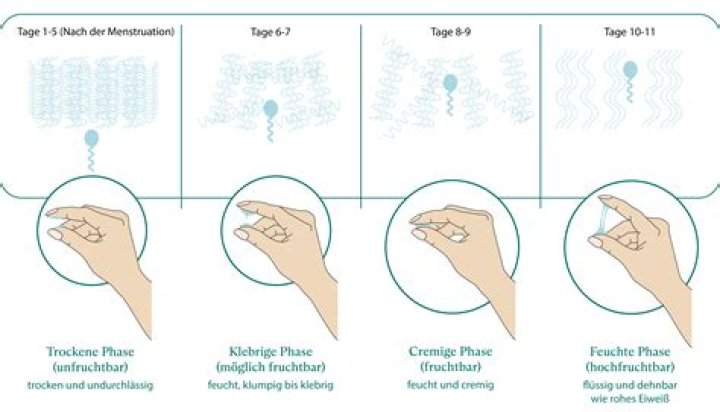 Wann kommt die erste Periode nach Kaiserschnitt