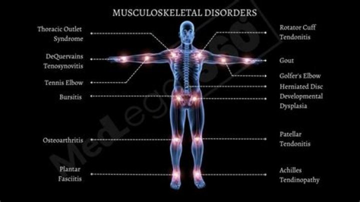 What causes musculoskeletal disorders