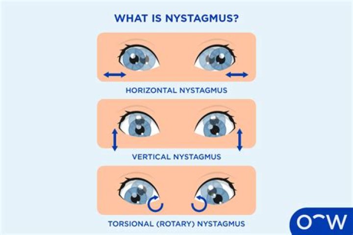 What causes nystagmus other than alcohol