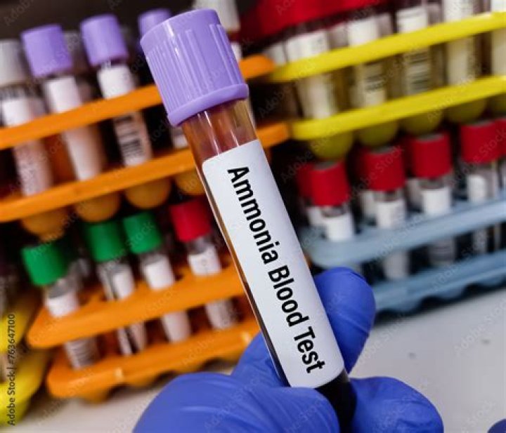 What does ammonia blood work test for