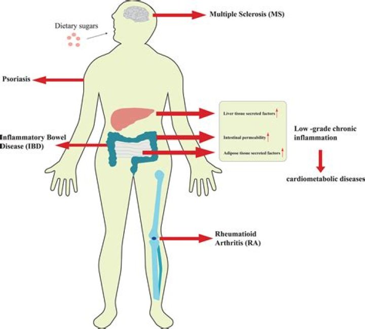 What inflammatory skin disorder is caused by excess sebum production