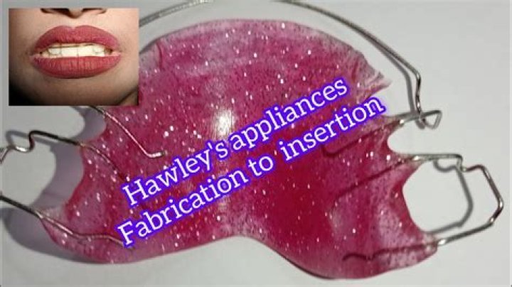 What is a Hawley appliance