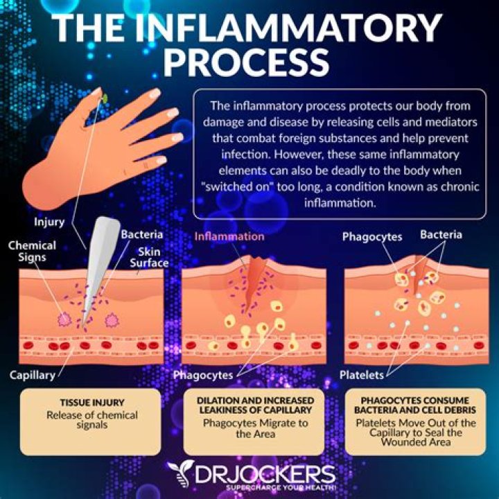 What is inflammation of mouth