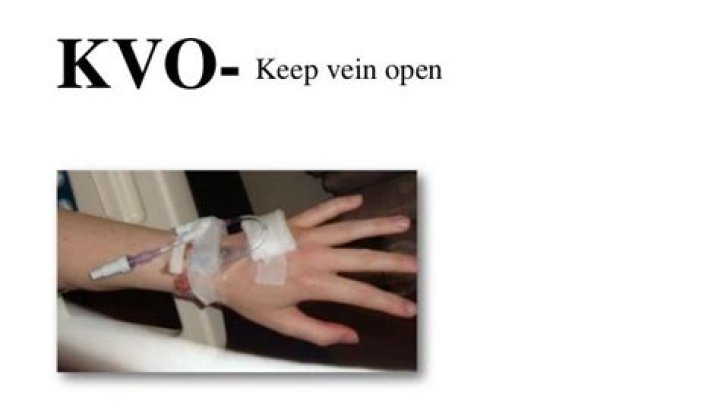 What is keep vein open rate