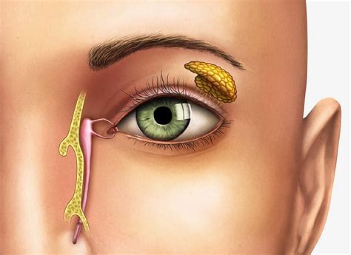 What is tear duct surgery