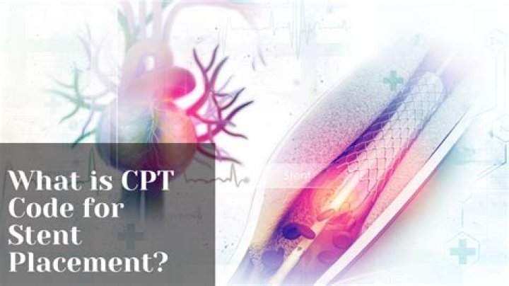 What is the CPT code for stent removal