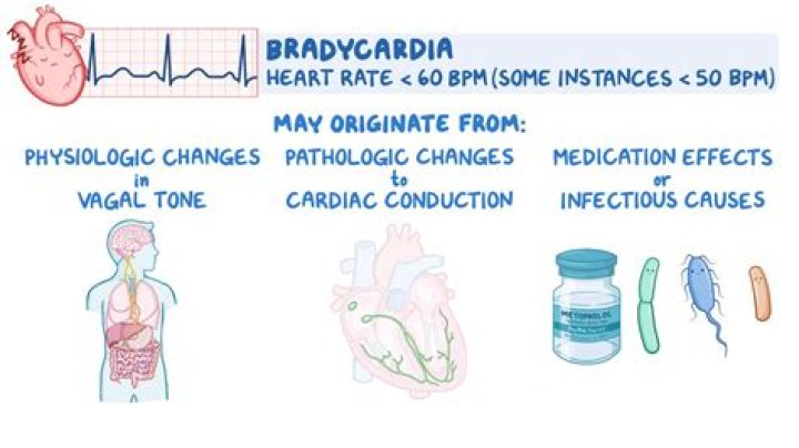 What is the treatment of bradycardia