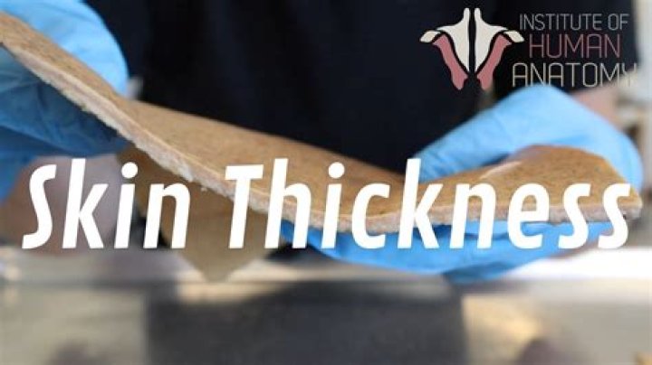 What is thick skin in the human