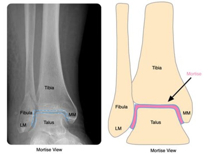 What joints make up the ankle mortise