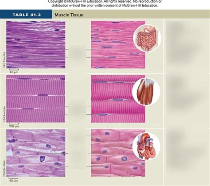 What type of muscle tissue is the Arrector pili muscle