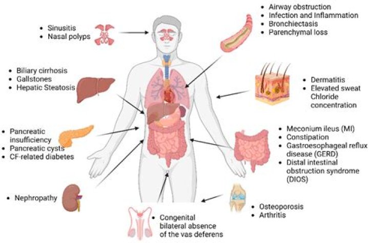 Which organs are most commonly affected by postoperative complications in older adults