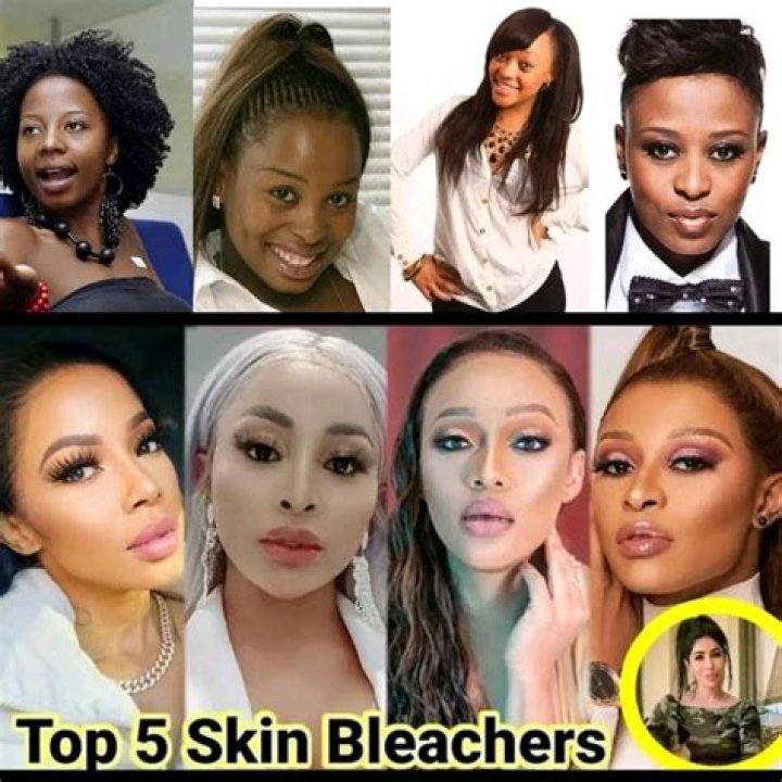 Who bleached their skin on Love and Hip Hop